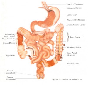 Just some of the ailments that an unhealthy bowel can lead to.